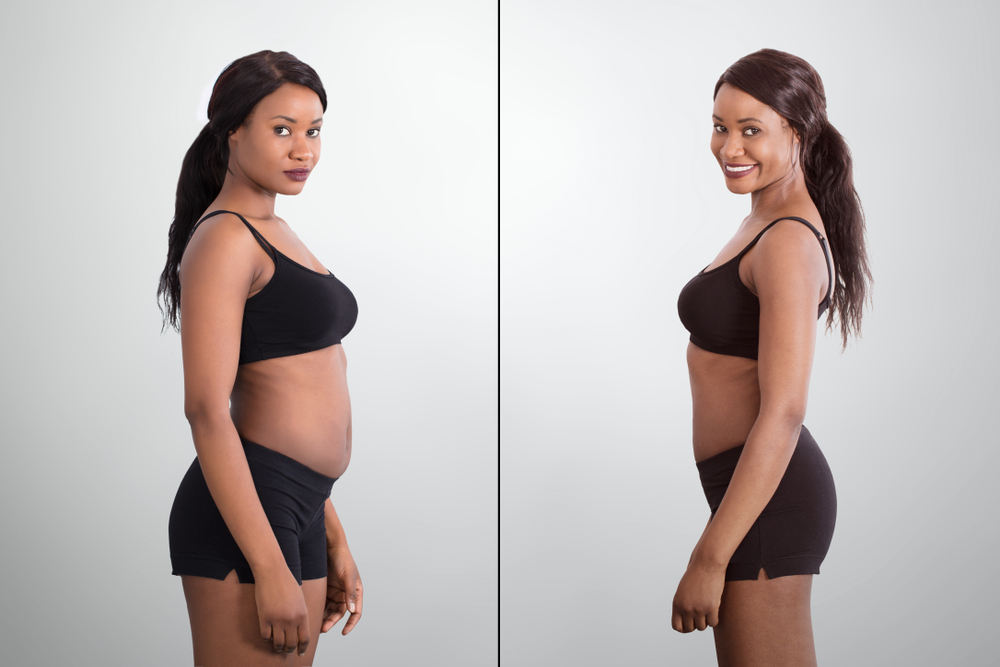 Before,And,After,Concept,Showing,Fat,To,Slim,African,Woman Online Weight Loss in Naperville, IL